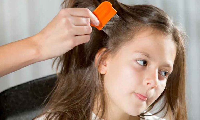 Remedies for lice